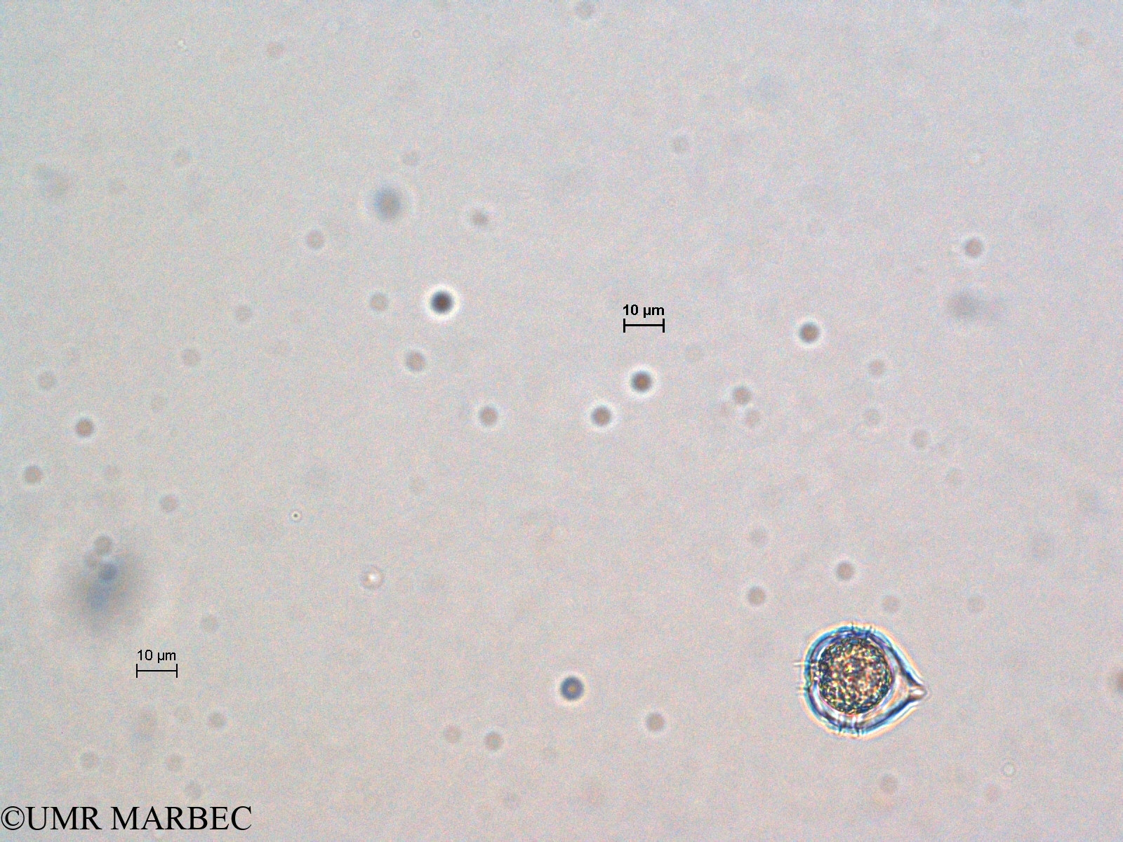phyto/Scattered_Islands/all/COMMA April 2011/Protoperidinium sp7 (5)(copy).jpg